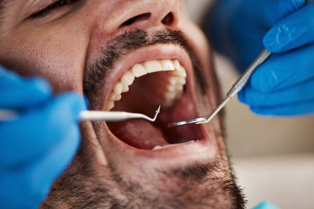Best Teeth Whitening  in East Lexington, VA